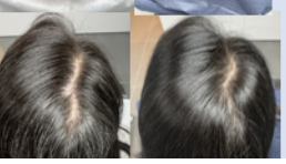 Atelier shampooing progressive pour camoufler vos premiers cheveux blancs, à ST OUEN 